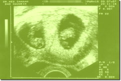 Ultrasound Scan Art Print 15 x 10 cm - Olive green