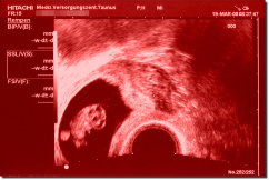 Ultrasound Scan Art Print 30 x 20 cm - Dark red