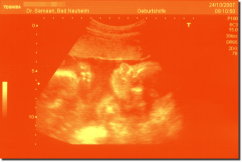 Ultrasound Scan Art Print 30 x 20 cm - Orange red
