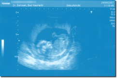 Ultrasound Scan Art Print 30 x 20 cm - Sky blue