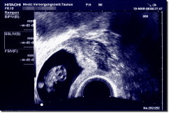 Ultrasound Scan Art Print 60 x 40 cm - Black / blue