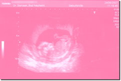 Ultrasound Scan Jigsaw - Pastel pink