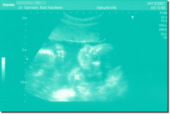 Ultrasound Scan Jigsaw - Turquoise