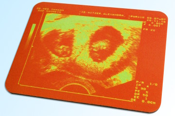 Ultraschallbild Mousepad