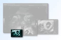 Ultrasound Scan Art Print 15 x 10 cm