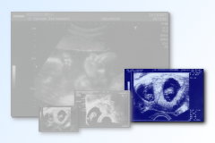 Ultrasound Scan Art Print 30 x 20 cm