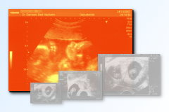 Ultrasound Scan Art Print 60 x 40 cm